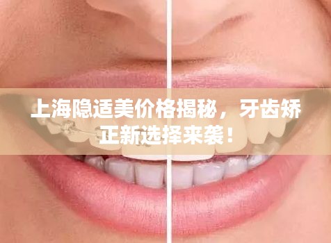 上海隐适美价格揭秘，牙齿矫正新选择来袭！