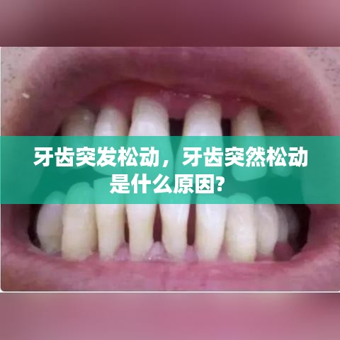 牙齿突发松动，牙齿突然松动是什么原因? 