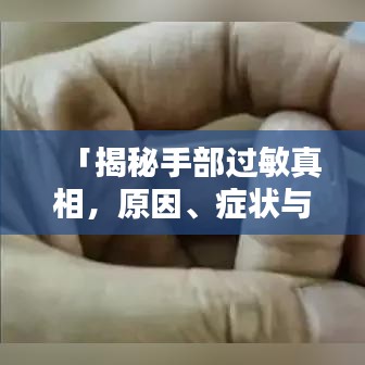 「揭秘手部过敏真相，原因、症状与应对方法，百度来解答你的疑惑」