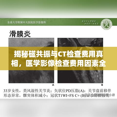 揭秘磁共振与CT检查费用真相，医学影像检查费用因素全解析