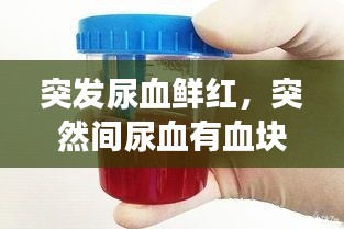 突发尿血鲜红，突然间尿血有血块还特别红是怎么回事 